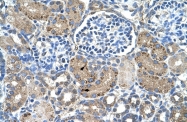ARP43562_T100 - Glutaminase liver isoform