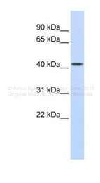 ARP43570_P050 - Carboxypeptidase B2