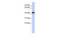 ARP43572_P050 - Alcohol dehydrogenase 4 / ADH4