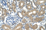 ARP43573_T100 - Alcohol dehydrogenase 4 / ADH4