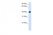 ARP43573_T100 - Alcohol dehydrogenase 4 / ADH4