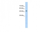 ARP43584_T100 - MeCP2