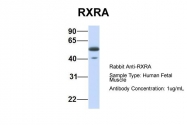 ARP43586_P050 - RXR-alpha / RXRA