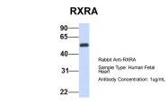 ARP43586_P050 - RXR-alpha / RXRA