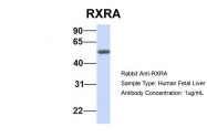 ARP43586_P050 - RXR-alpha / RXRA