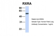 ARP43586_P050 - RXR-alpha / RXRA