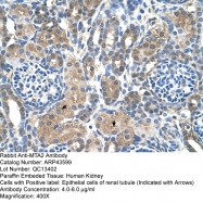 ARP43599_T100 - MTA2