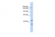 ARP43622_P050 - ABCC8