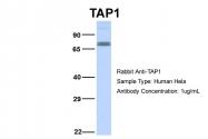 ARP43628_P050 - ABCB2 / APT1 / TAP1