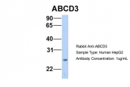 ARP43641_P050 - ABCD3 / PMP70