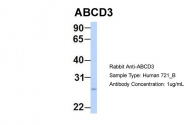 ARP43641_P050 - ABCD3 / PMP70