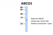 ARP43641_P050 - ABCD3 / PMP70