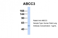ARP43645_P050 - ABCC3 / CMOAT2 / MRP3