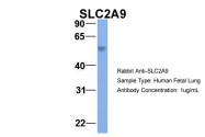 ARP43757_P050 - SLC2A9 / GLUT9