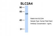 ARP43785_P050 - GLUT4 / SLC2A4