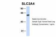 ARP43785_P050 - GLUT4 / SLC2A4