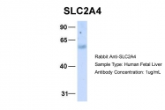 ARP43785_P050 - GLUT4 / SLC2A4