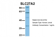 ARP43855_P050 - SLC27A2 / FATP2