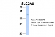 ARP43951_P050 - GLUT8 / SLC2A8