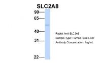 ARP43951_P050 - GLUT8 / SLC2A8