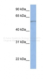 ARP43994_P050 - SLC22A11 / OAT4