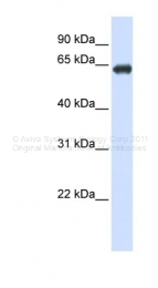 ARP44090_P050 - Zinc transporter ZIP4 / SLC39A4