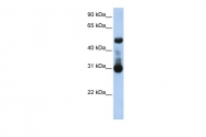 ARP44199_P050 - ACVRL1 / ALK1