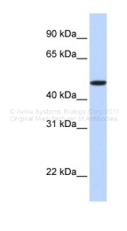 ARP44216_P050 - Erythropoietin receptor