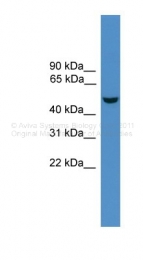 ARP44217_P050 - Erythropoietin receptor
