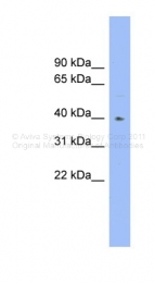 ARP44222_P050 - Fucosyltransferase 1