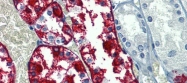 ARP44224_P050 - Glucose-6-phosphatase / G6PC