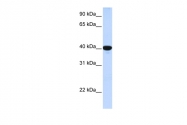 ARP44224_P050 - Glucose-6-phosphatase / G6PC
