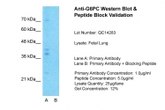 ARP44224_P050 - Glucose-6-phosphatase / G6PC