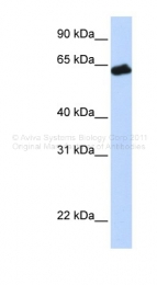 ARP44230_P050 - Growth hormone receptor