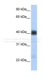 ARP44244_P050 - SGCB (Beta-sarcoglycan)