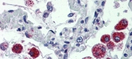 ARP44276_P050 - Cytochrome b-245 heavy chain