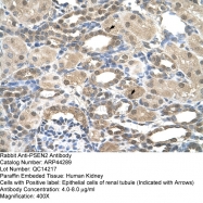 ARP44289_P050 - Presenilin-2