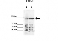 ARP44289_P050 - Presenilin-2