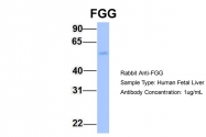 ARP44299_P050 - Fibrinogen gamma chain