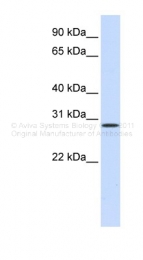 ARP44318_P050 - Hepatocyte growth factor / HGF