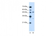 ARP44329_P050 - M-CSF / CSF-1