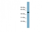 ARP44331_P050 - M-CSF / CSF-1