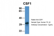 ARP44331_P050 - M-CSF / CSF-1
