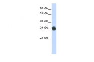 ARP44354_P050 - KITLG / SCF