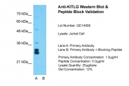 ARP44354_P050 - KITLG / SCF