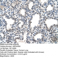 ARP44365_T100 - Cyclophilin B