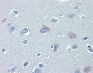 ARP44380_P050 - TRPM2 / TRPC7