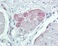 ARP44380_P050 - TRPM2 / TRPC7