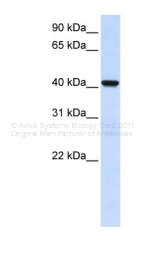 ARP44425_P050 - DGAT2L4 / AWAT2