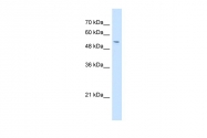 ARP44499_P050 - GPNMB / HGFIN